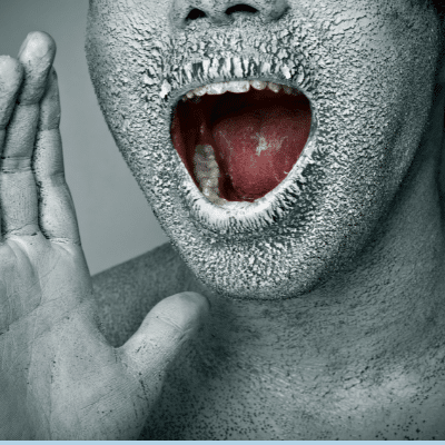 Do you have dry mouth? What can you do? 10 Blog dry mouth