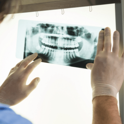 Dental x-rays 8 Dental x-ray