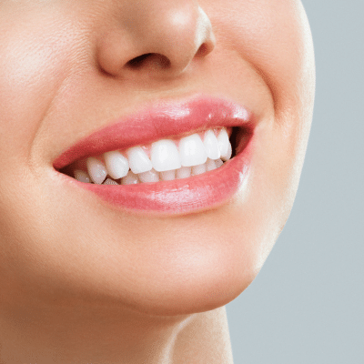 Teeth whitening options: a complete guide to a brighter smile 2 Closeup of a woman's white teeth, representing teeth whitening options